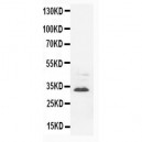 Synaptophysin Antibody (monoclonal)