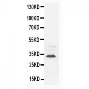 Synaptophysin Antibody (monoclonal)