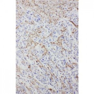 Syndecan 2 Antibody