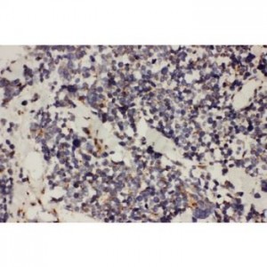 TAB2 Antibody