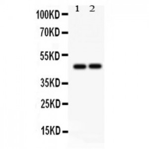 TCPTP  Antibody