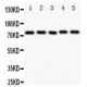 Tec Antibody