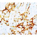 Tenascin Antibody (monoclonal)