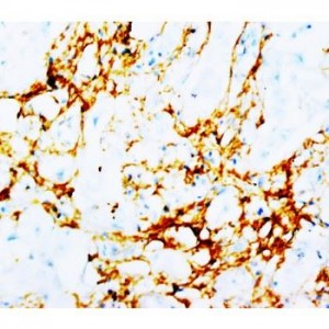 Tenascin Antibody (monoclonal)