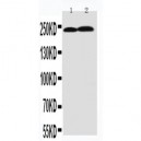 Tenascin C Antibody