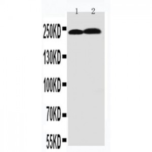 Tenascin C Antibody