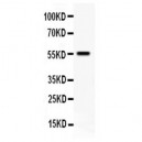 TFPI Antibody