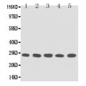 TFPI2 Antibody