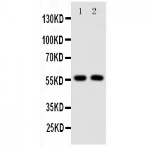 TGF beta Receptor I Antibody