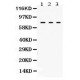 TGM2  Antibody