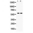 TH  Antibody