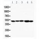 TIM 1 Antibody