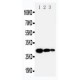 TIMP1 Antibody