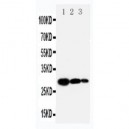 TIMP1 Antibody