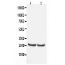 TIMP4 Antibody