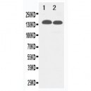 TJP2 Antibody