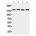 TJP2 Antibody