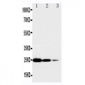 TNF Receptor I Antibody