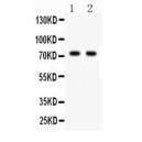 TNF Receptor II  Antibody