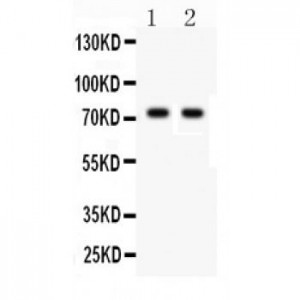 TNF Receptor II  Antibody