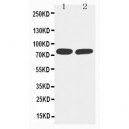 TNF Receptor II Antibody