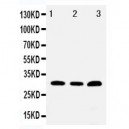 Tollip Antibody