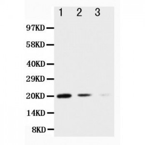 TRAIL Antibody