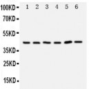 TRAM1 Antibody