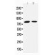 Transglutaminase 2 Antibody