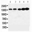 TrkA Antibody