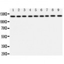 TRPC3 Antibody