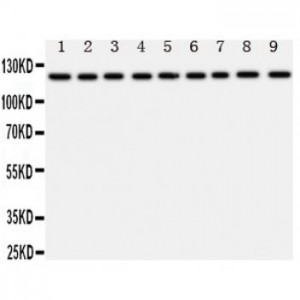 TRPC3 Antibody