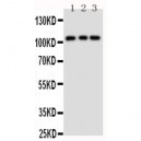 TRPC6 Antibody