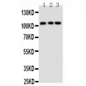 TRPC6 Antibody