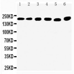 TRPM2 Antibody