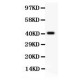 Tuberin  Antibody