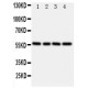 TXNRD2 Antibody