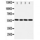 TXNRD2 Antibody