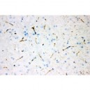 Tyrosine Hydroxylase Antibody (monoclonal)