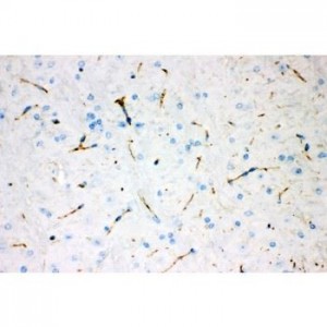 Tyrosine Hydroxylase Antibody (monoclonal)