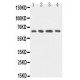 uPA Receptor Antibody