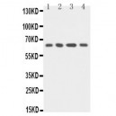 uPA Receptor Antibody