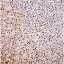 VCP Antibody