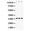 VDAC/Porin  Antibody