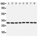 VDAC/Porin Antibody