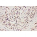 VEGF  Antibody