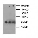 VEGF Antibody