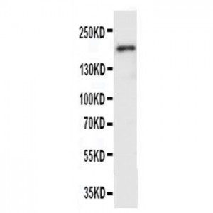 VEGF Receptor 2 Antibody