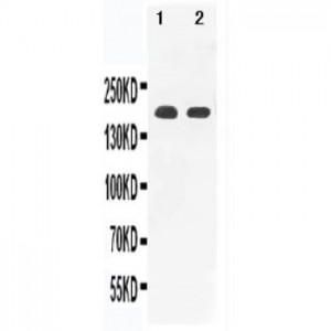 Versican Antibody