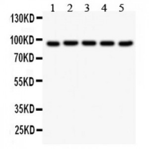 Villin  Antibody